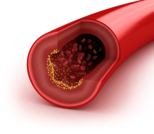 Arginine, Carnitine and Taurine reduce bad LDL cholesterol and increase longevity