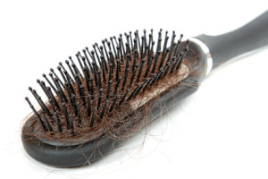 hair loss is very common but can be reduced with the right nutrients